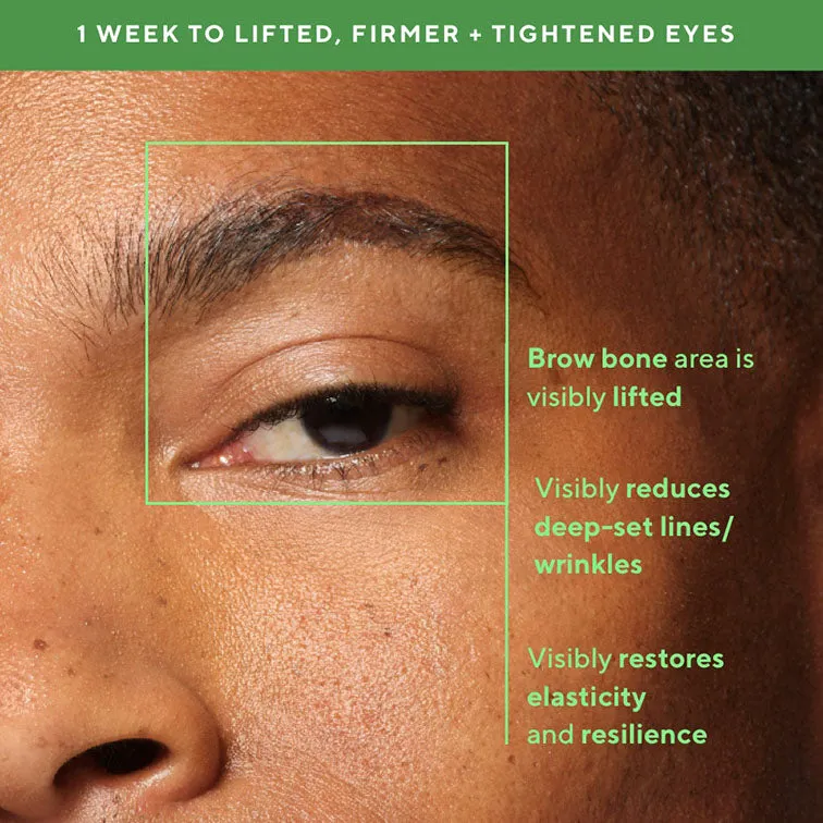 Retinal ReSculpt™ Eye Lift Treatment